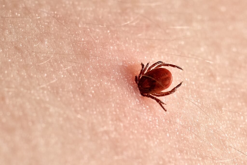 Florida Ticks - Tick on the skin