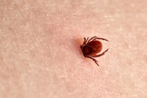 Florida Ticks - Tick on the skin