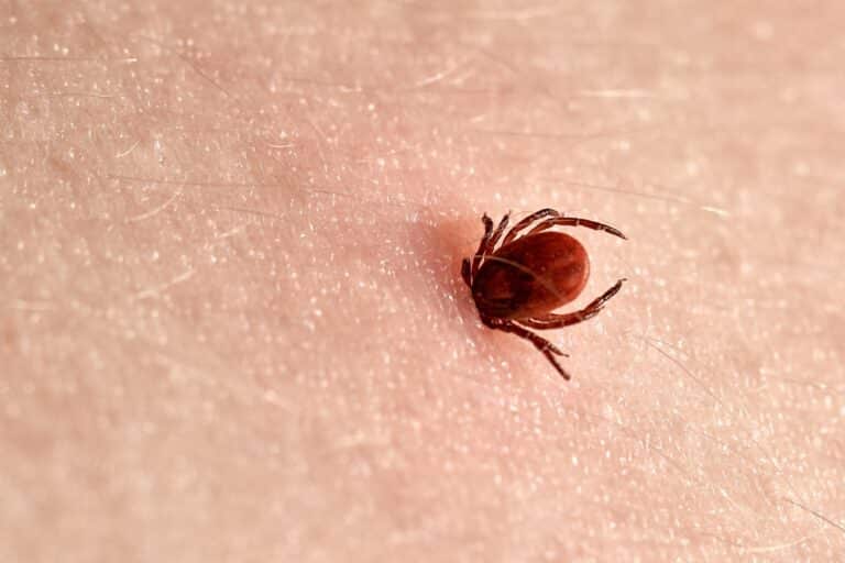 Florida Ticks - Tick on the skin